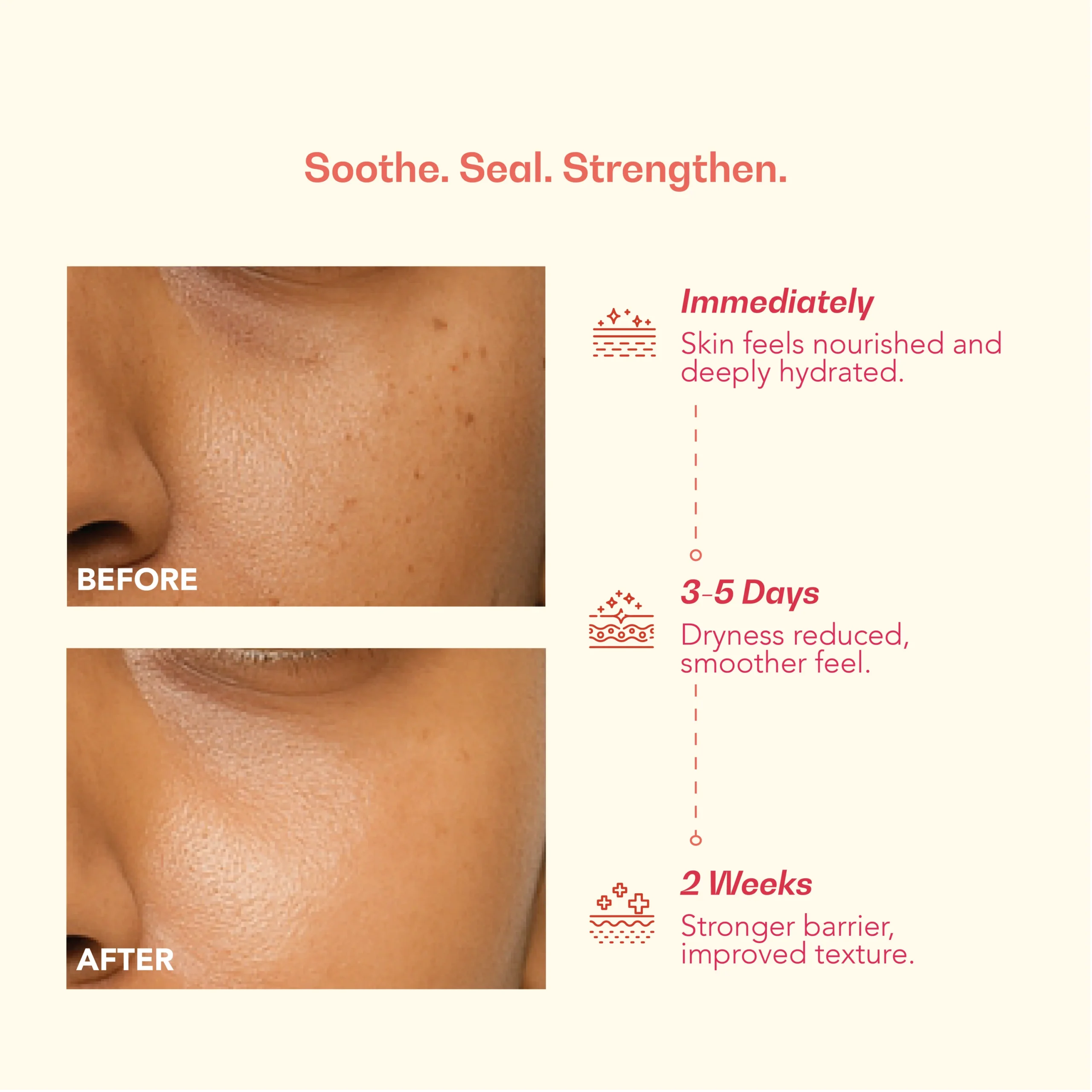 Nourish My Skin Ceramide Moisturizer (50 g) - Image 4