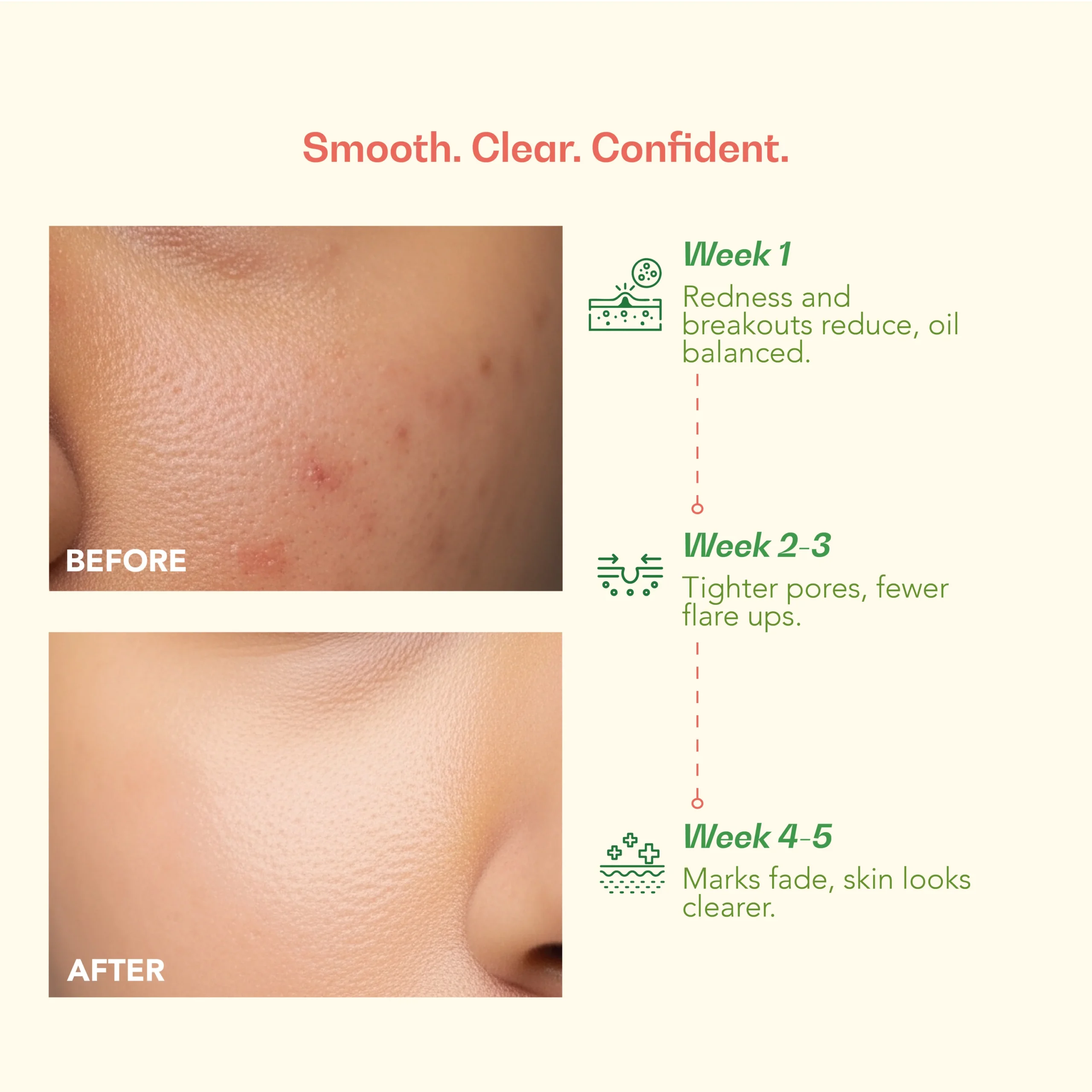 Clear My Skin Salicylic Acid Serum (30 g) - Image 4